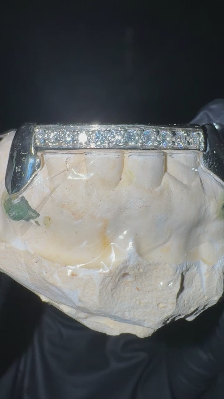 925 Silver Grillz (Moissanite Bar)